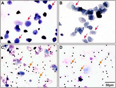 Laterality Influences Central Integration of Baroreceptor Afferent Input in Male and Female Sprague Dawley Rats